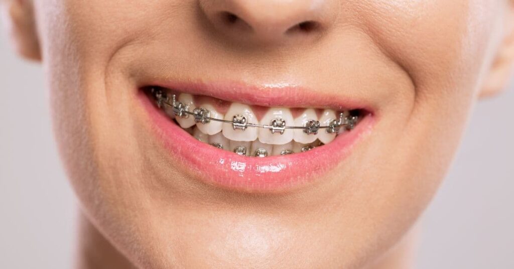 Orthodontist